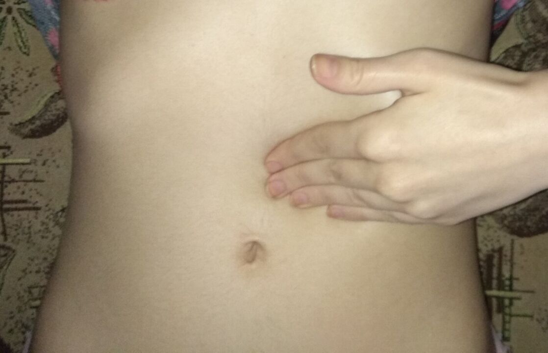 Urdaila osasuntsua NEOflorax kapsulekin tratatu ondoren