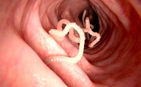 zizareak giza gorputzean