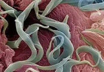 Giza gorputzean parasitoen sintomak eta tratamendua