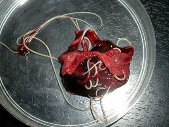 giza gorputzeko zizareak