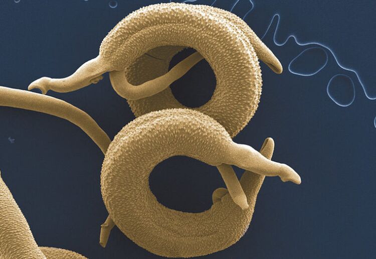 giza gorputzean bizi diren parasitoak