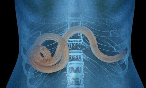 parasitoa giza gorputzean